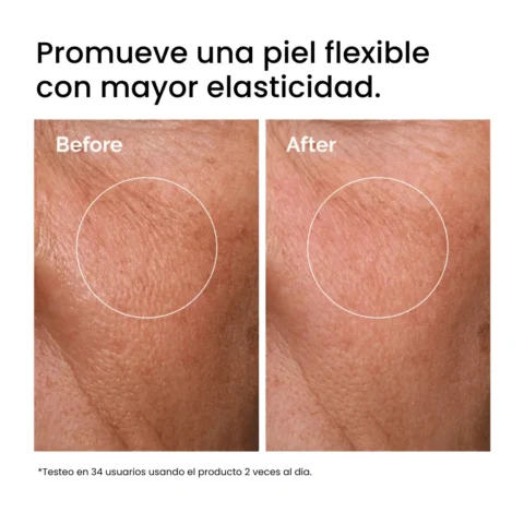 Hyaluronic Acid The Ordinary Test