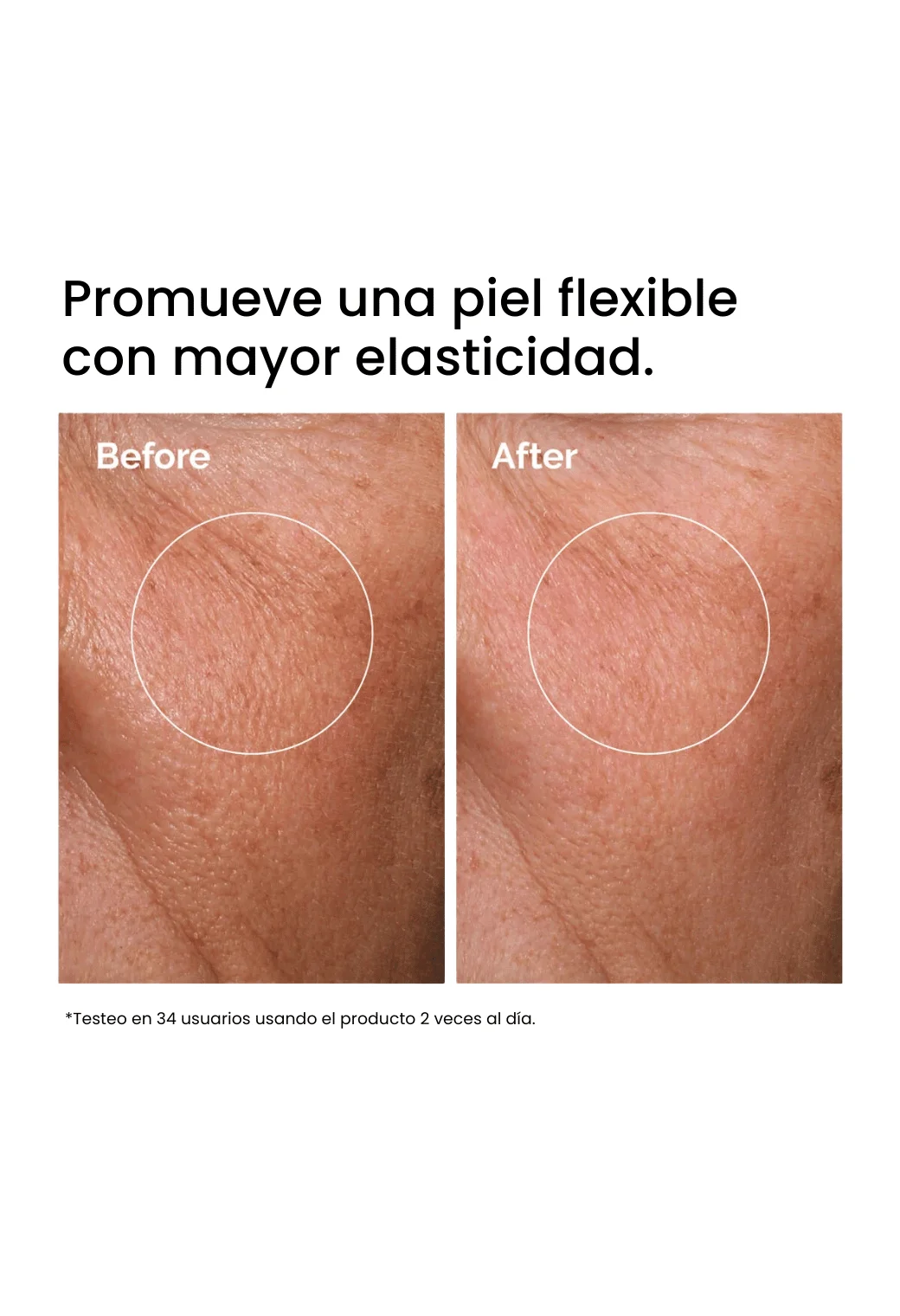 Hyaluronic Acid The Ordinary Test