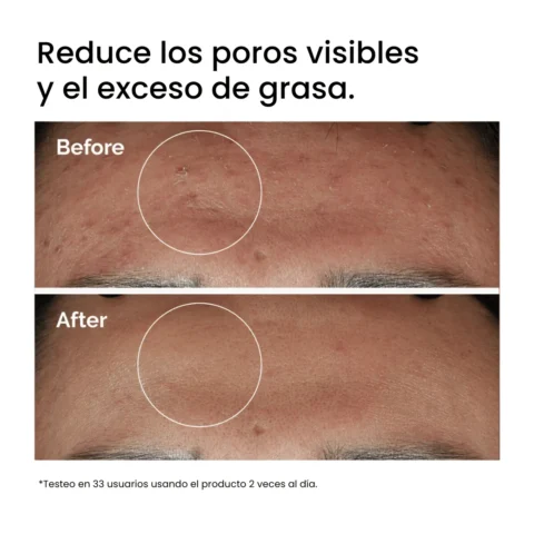 Niacinamide 10% + Zinc 1% The Ordinary Test